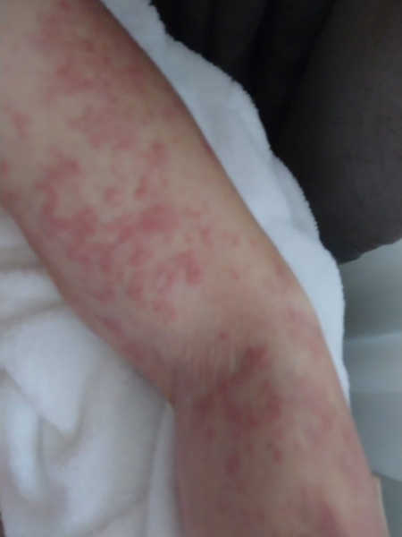 Skin problems in DF - pics attached