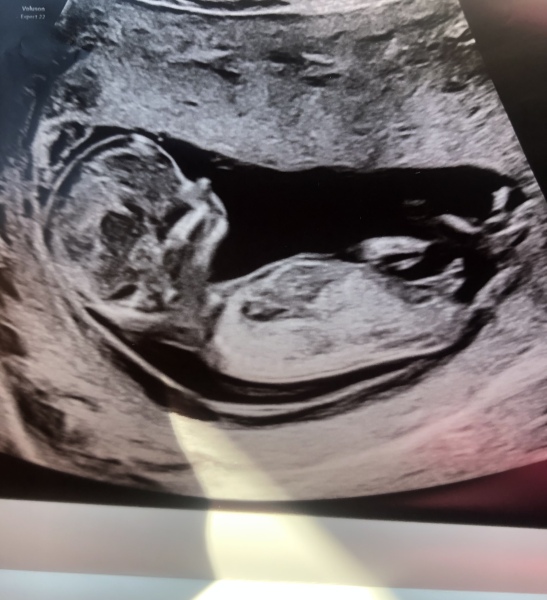 March 2024 continued!