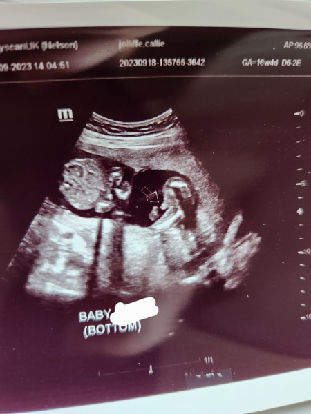 Gender guesses for my twins please 💕