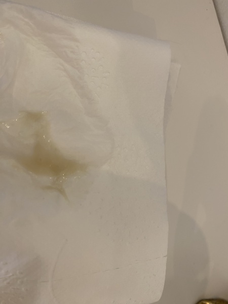 Is this normal?