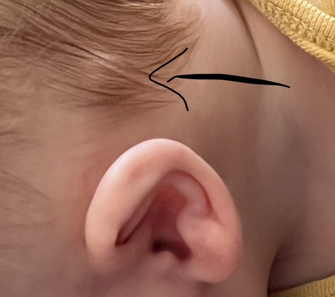 Can you see lymph nodes on your infants?