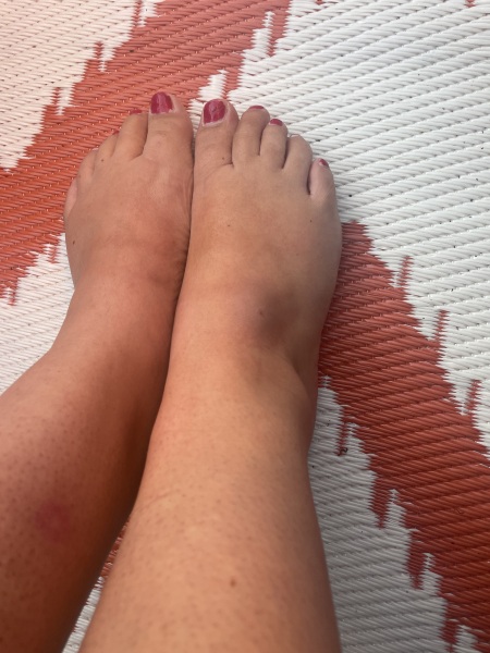 Should I go to minor injuries (photo)