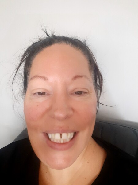 Got new teeth....need honest opinions please