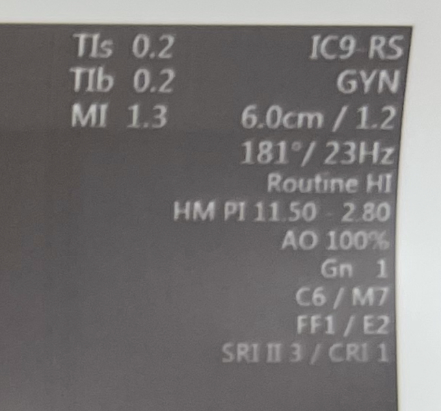 What do the letters and words mean on my pregnancy scan? Photo included