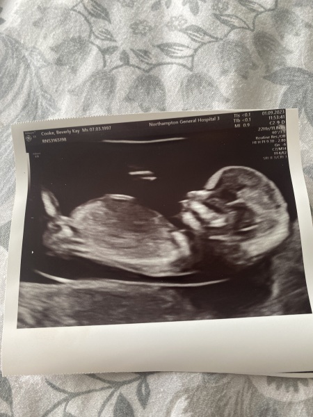 12 week scan pic, boy or girl?