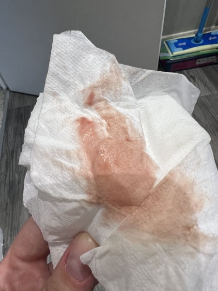 Ovulation bleeding?