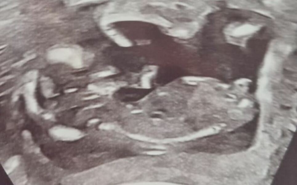 Boy or Girl
