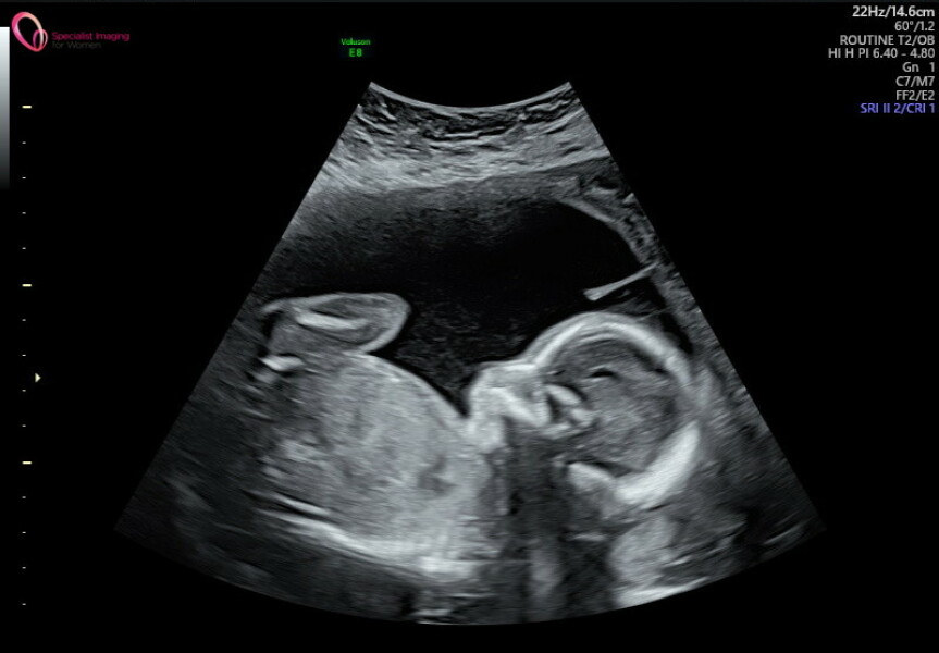 Boy or Girl? Scan photos 