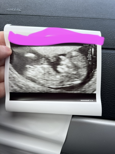 Gender guesses please!