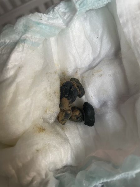 My 1 year olds poo colour is black? (PIC included)