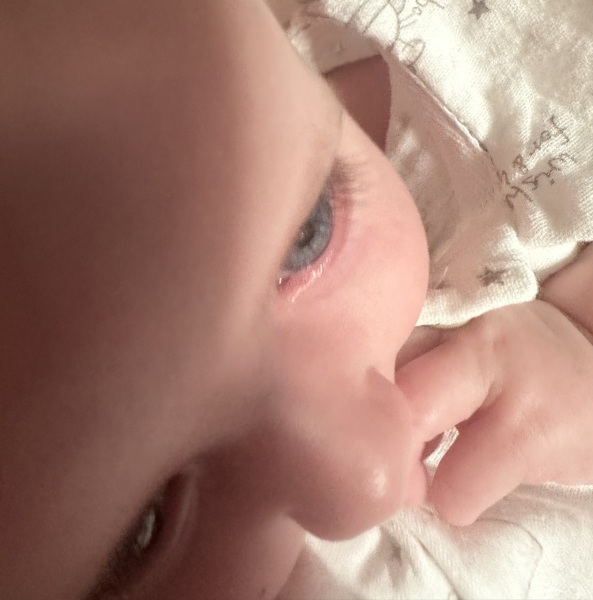 Can't work out if DD's eye is swollen?