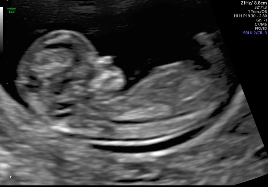 Any gender guesses?