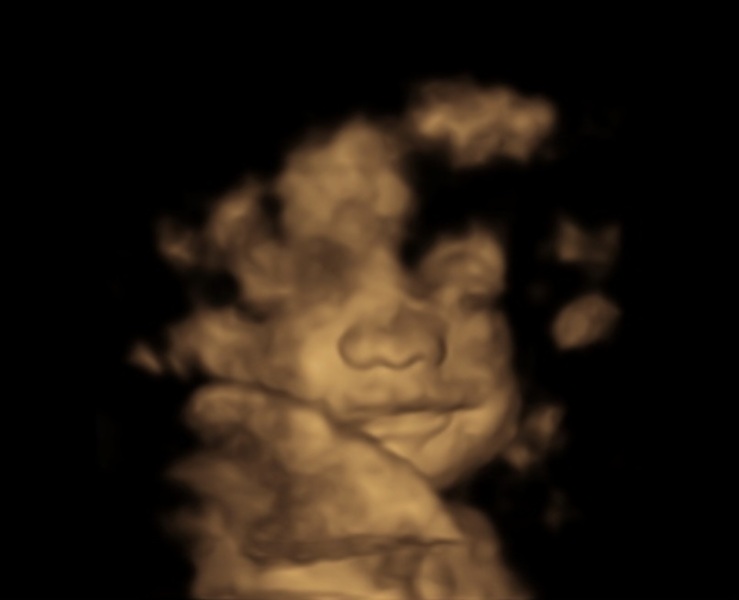 November 2023 babies - Thread 5