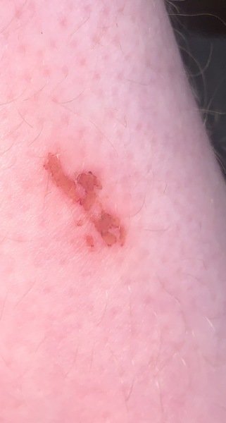 *WARNING PIC* Forgive me for being rather stupid! What could this be and what do I do with it!