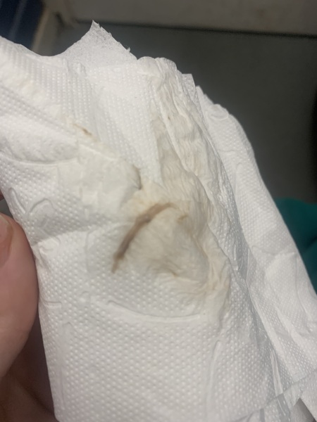 Implantation bleeding ?