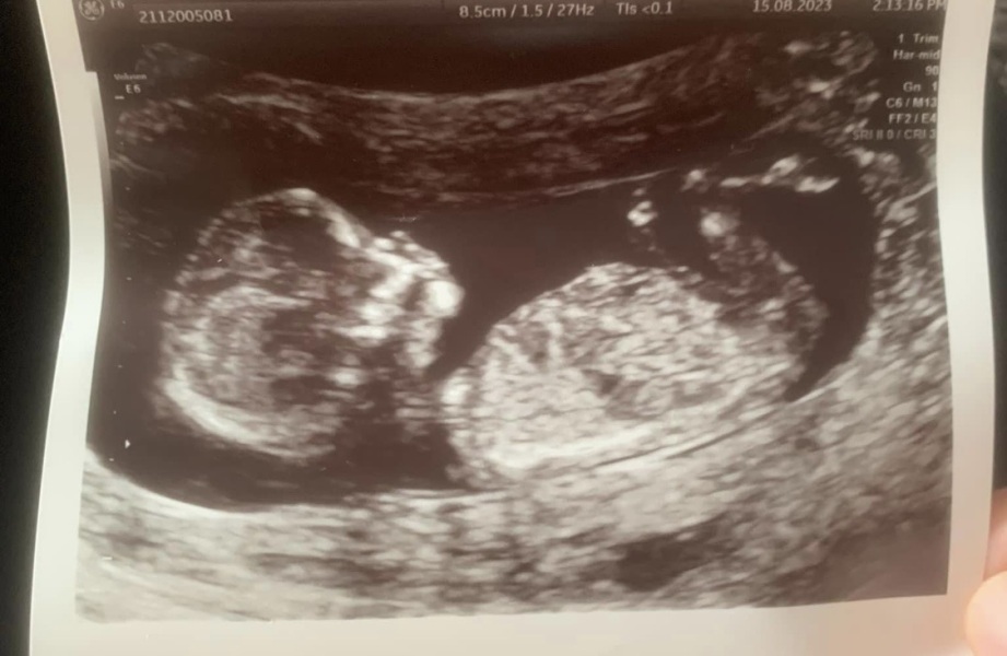 Baby gender booked