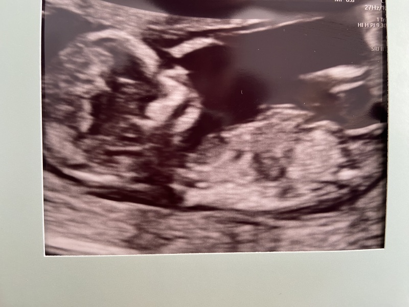 IVF Buddies: the next chapter