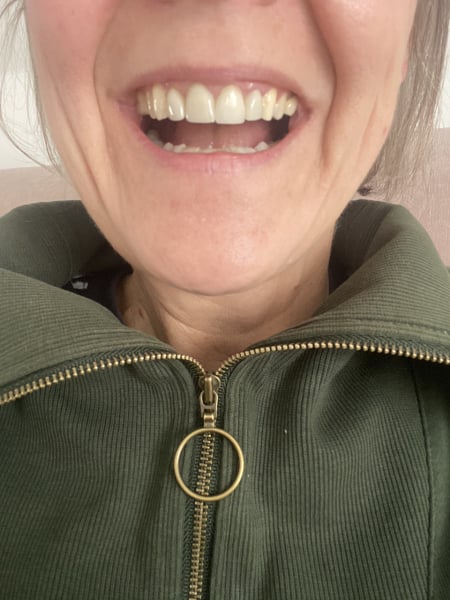 Got new teeth....need honest opinions please
