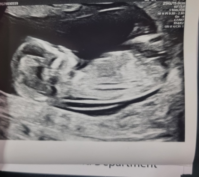 Nub Theory