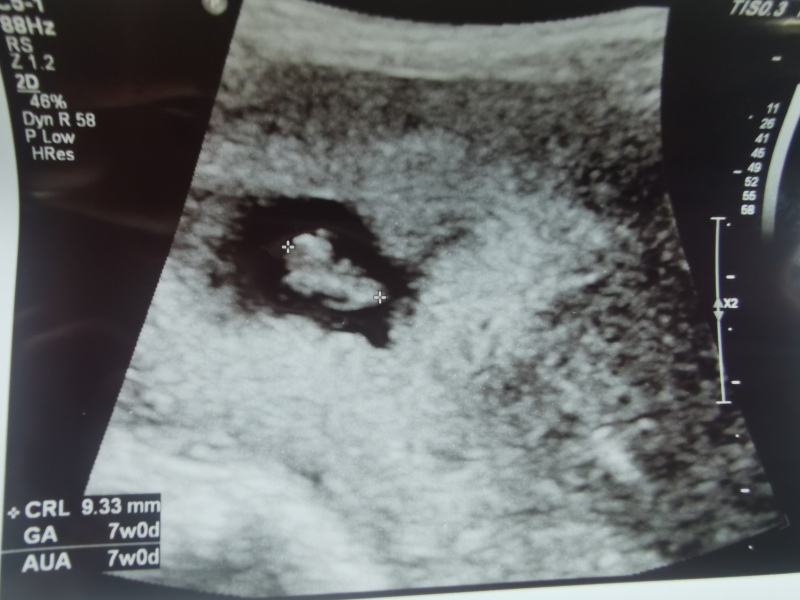 Late April 2024 / Early May 2024