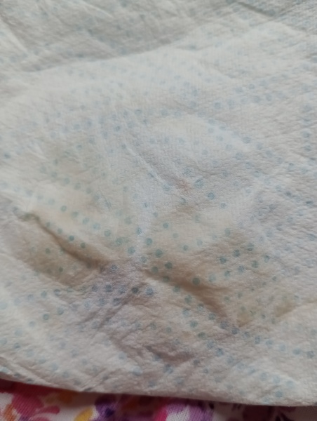 8 weeks and discharge pls help.