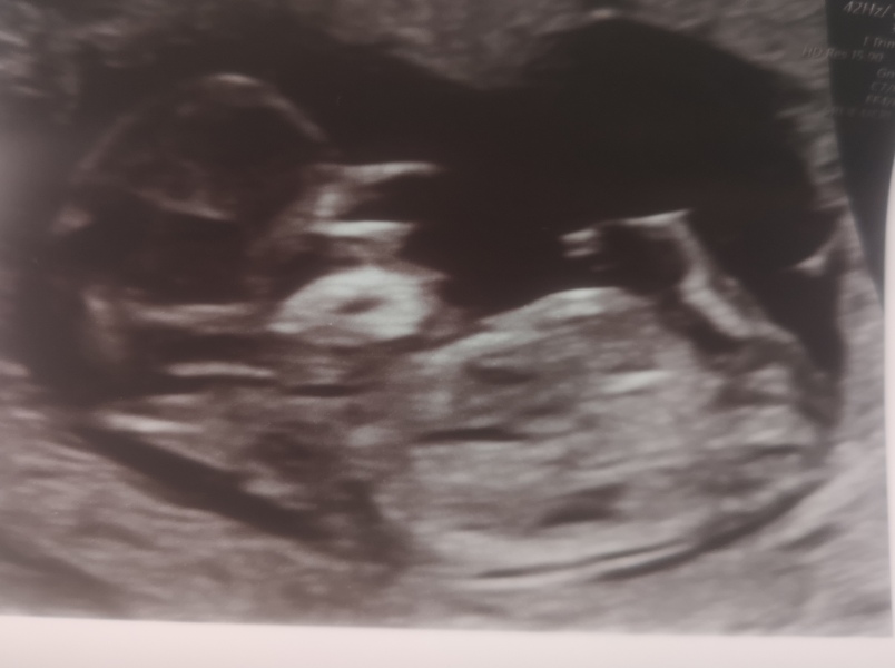 Scan gender guesses.