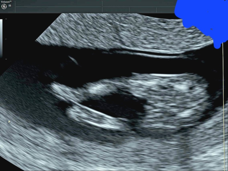 Boy or girl?