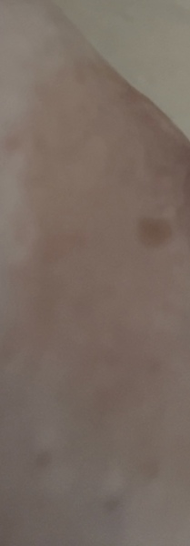 Starting to worry about this ‘mark’ next to my nipple