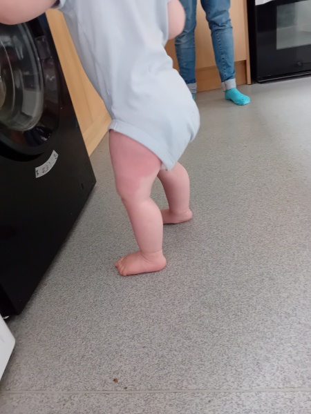 Bad reaction to 1yr immunisations