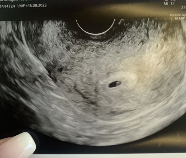 Due May 2024?
