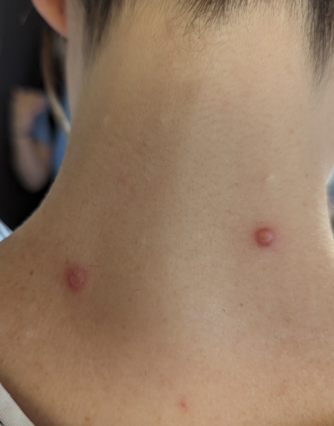 Anyone know what these spots are? (Photo included)