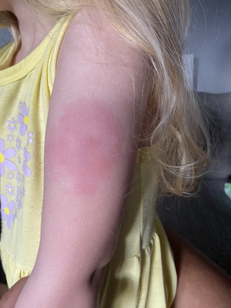 Vaccine dash