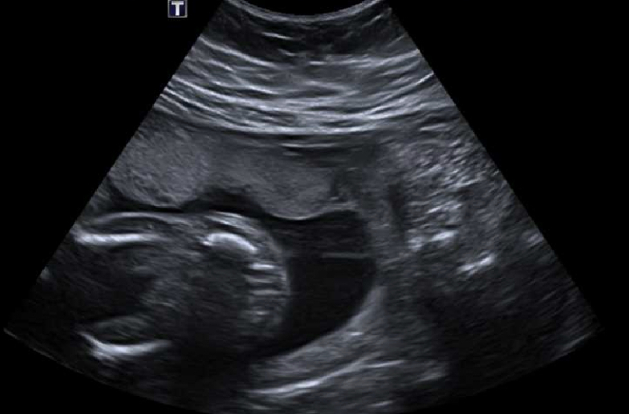 20 week gender guesses!