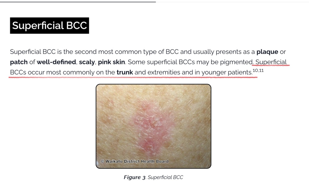 Basal cell carcinoma?