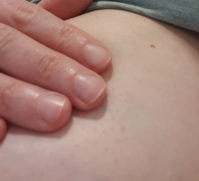 What are these? Blackheads? (Photos!)