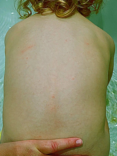 Spots on my toddler?
