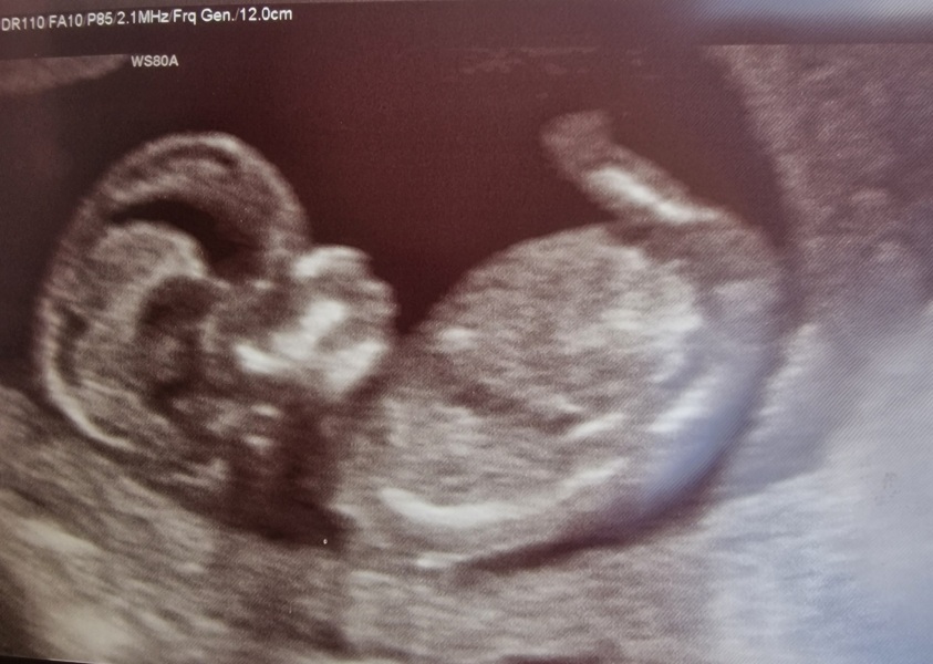 gender prediction?