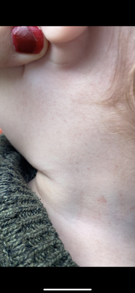 Please help is this a rash?
