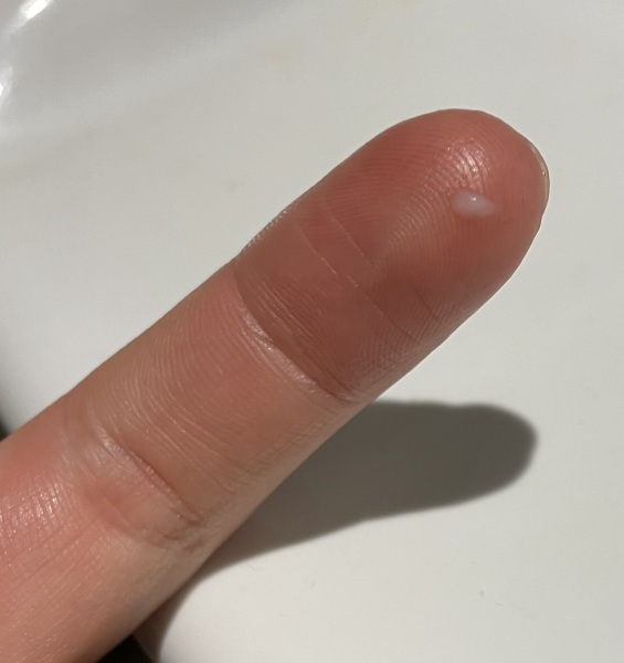 Cervical mucus