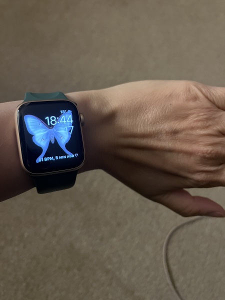 Has anyone got an Apple Watch SE?