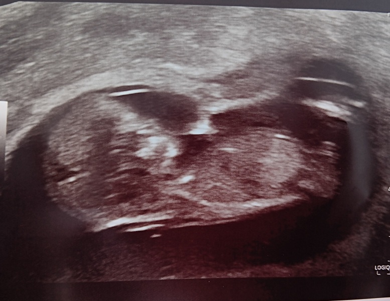 March 2024 continued!