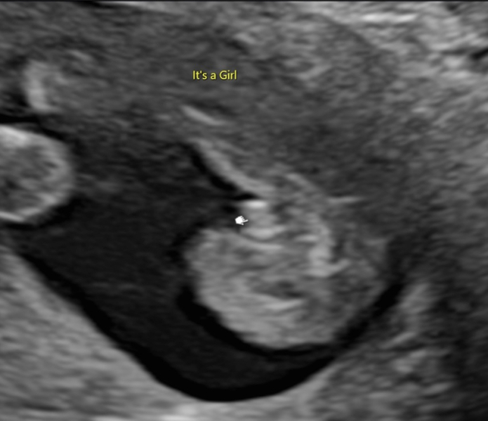 Boy or girl?