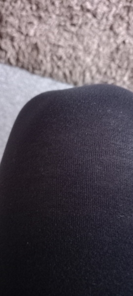 Knee pain/lump