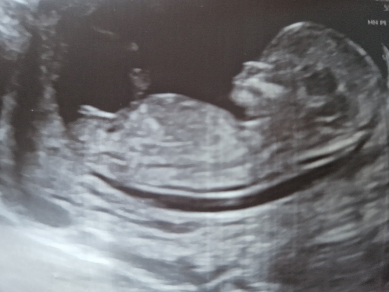 Boy or girl?