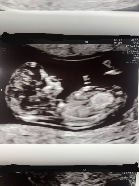Boy or girl?