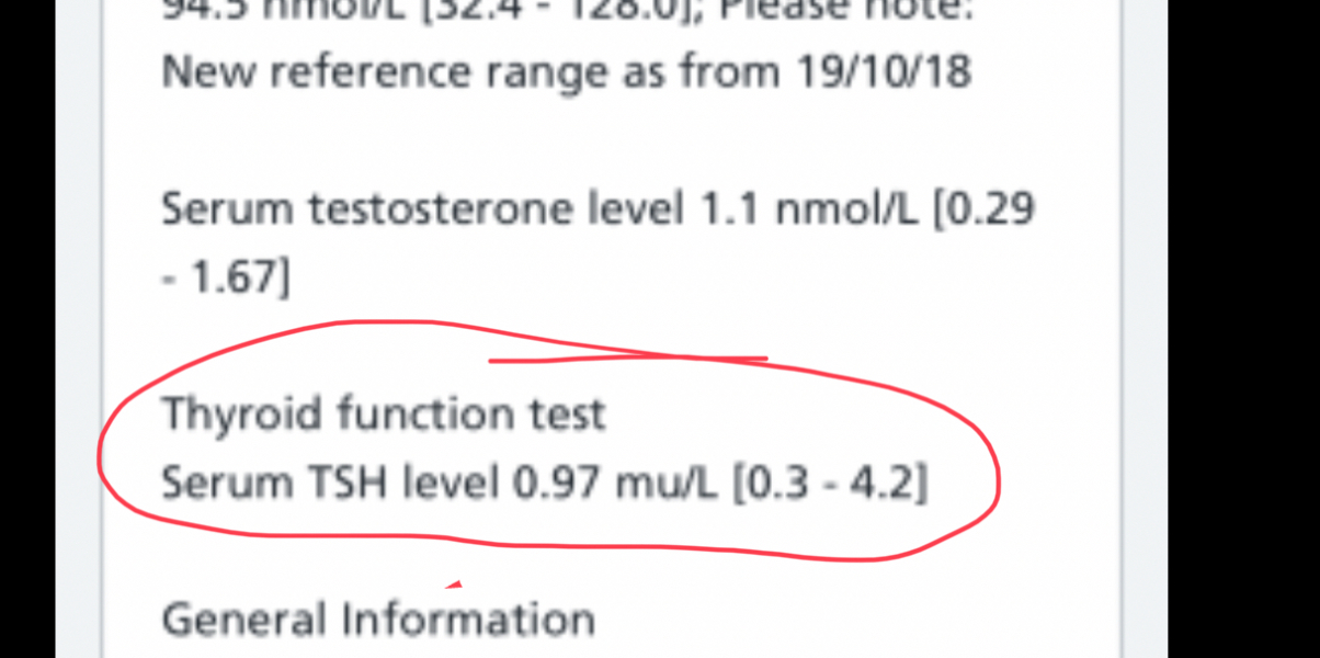 Overactive thyroid