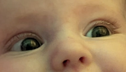 Does my baby have a (very) minor squint?