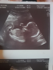 Boy or girl?