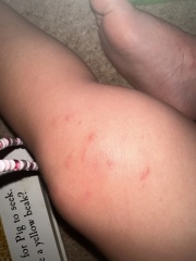 Strange rash…