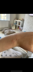 Sons friend biting - advice please!